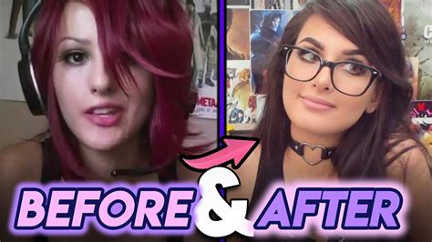 sssniperwolf before after|Sssniperwolf Before and After Plastic Surgery Rumours